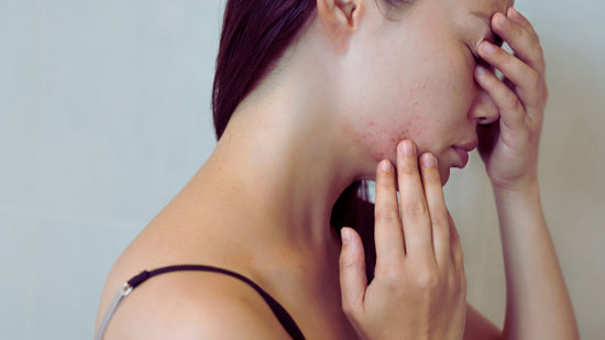 The Impact of Stress on Skin Health